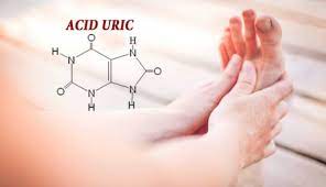 Acid Uric cao ảnh hưởng xương khớp 